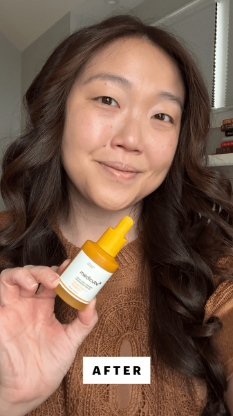 Lee after applying the Medicube Kojic Acid Turmeric Serum